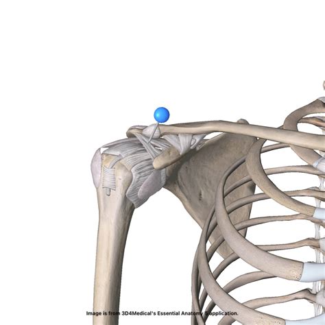 Rib Joint Sprain at Evelyn Turner blog