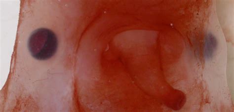 Real Monstrosities: Blind Octopus