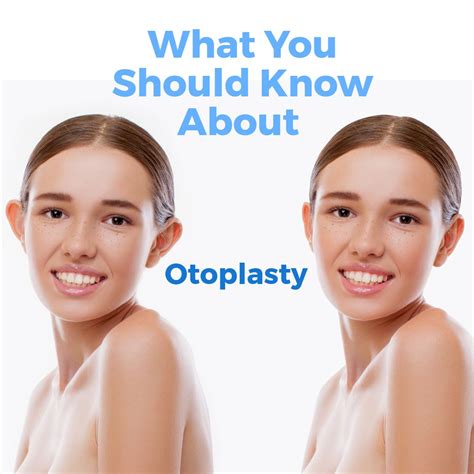 Are you considering having ear surgery done? | Ear pinning surgery, Plastic surgery, Surgery