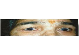 Eye Hospital in Ahmedabad | Eye Surgery | Ophthalmologist In Ahmedabad