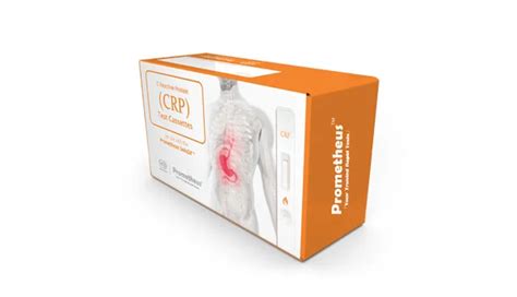 Image result for Prometheus Testing