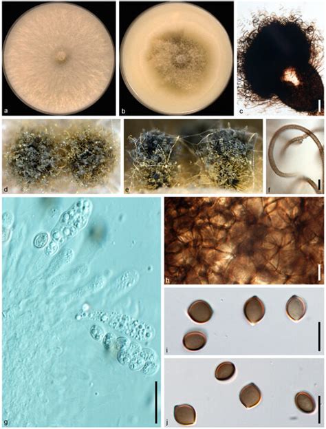 Three New Species and Five New Host Records from Chaetomiaceae with ...