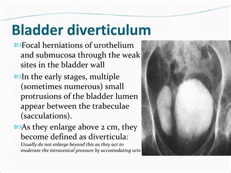 Intravenous urography (IVU) by Dr Bishnu Khatiwada, Conventional IVU, CT-IVU, MRI | PDF