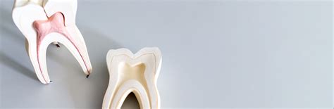 Root Canal Treatment at Best Dental Clinic in Hyderabad