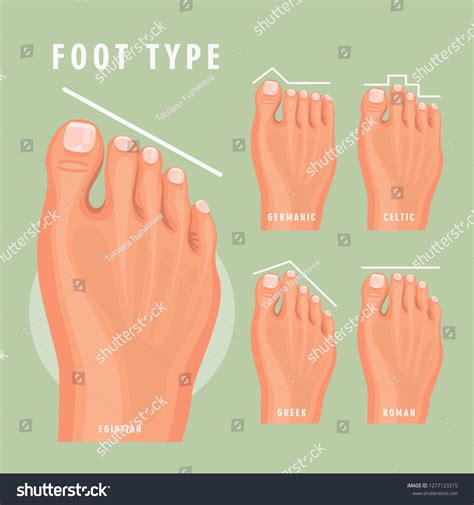 9,360 imágenes de Types of feet - Imágenes, fotos y vectores de stock ...