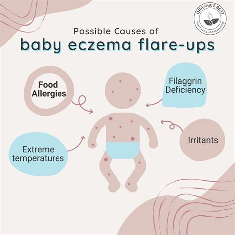 Baby Eczema On Belly