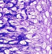Image result for osteoclast 破骨细胞