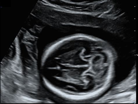 CD50 Pro AI - Konica Minolta