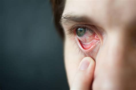 眼睛总是疼痛是怎么回事？引起眼睛痛的5种眼病，要警惕-搜狐大视野-搜狐新闻