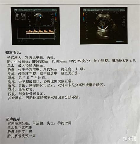 上海男子称孕39周妻子被赶出医院 院方：医院不收患流感孕妇_窦先生_手术_检测