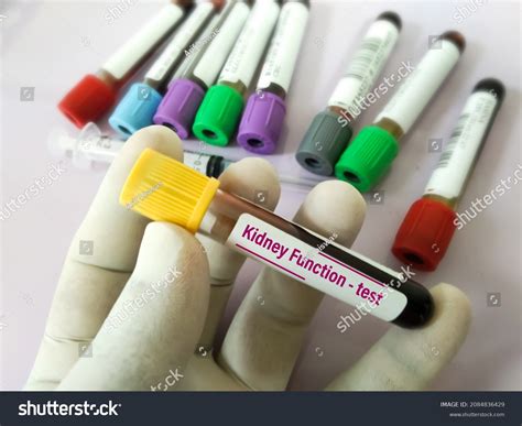 114 Renal Clearance Images, Stock Photos & Vectors | Shutterstock
