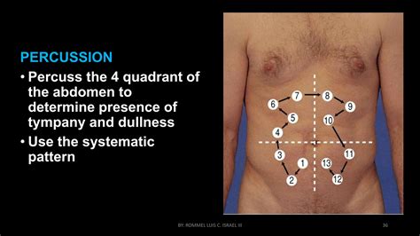HEALTH ASSESSMENT IN NURSING - ABDOMEN (2) | PPTX