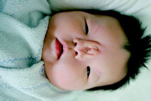 新生儿畸形高发 妈妈年龄大女婴“三只眼”(组图)-搜狐新闻