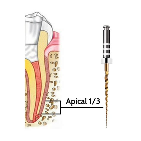 Waldent Retreatment Files – Waldent.com
