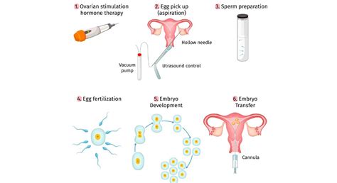 Stages & Treatment of IVF| Frozen Embryo Transfer: A Key Step in IVF