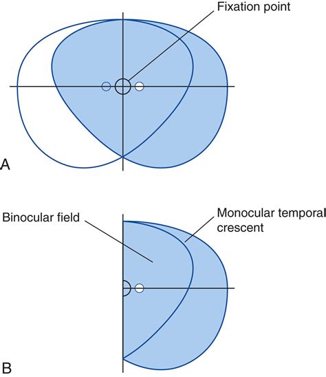 Image result for Visual Fields Red Pin