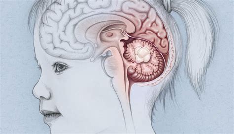 3 Major Causes and Symptoms of Brain Tumor - lifeberrys.com