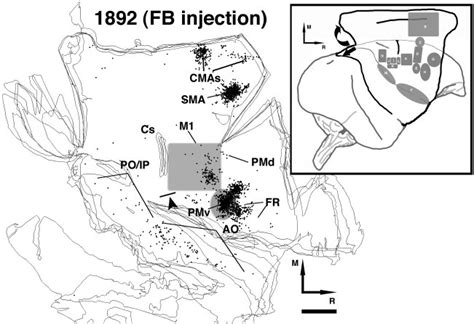Image result for Contralateral Hemisphere