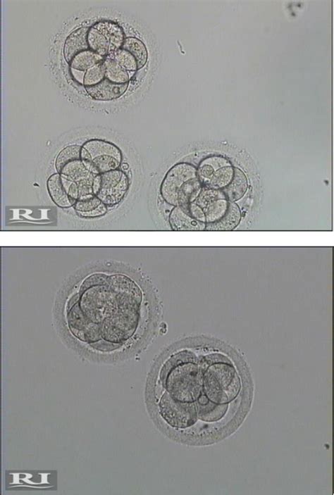 Image result for Magnetically Activated Cell Sorting