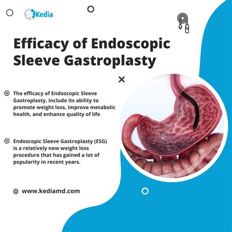 Exploring Efficacy of Endoscopic Sleeve Gastroplasty in Dallas, TX