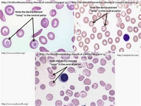 Image result for Target Cells