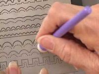 Pergamano Tutorials 的图像结果