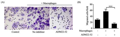 The Interaction of Adrenomedullin and Macrophages Induces Ovarian ...
