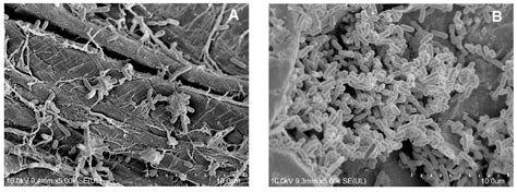 Immobilized Stenotrophomonas maltophilia KB2 in Naproxen Degradation