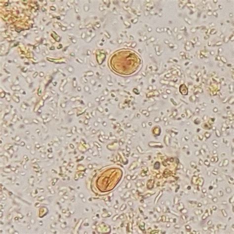 Pin su UNDER THE 🔬