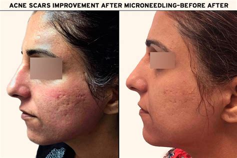 Revathi Hospital Salem - Skin Care | Dermatology | ENT Care | Plastic ...
