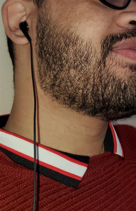 What is the potential of my facial hair ? : r/Minoxbeards