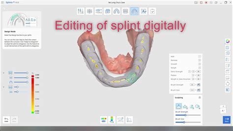 Image result for Inlab Splint Design