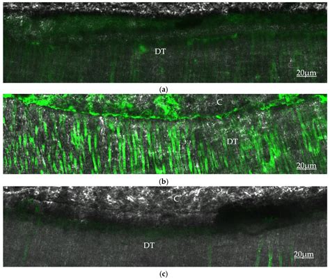 Effect of Endodontic Irrigating Solutions on Radicular Dentine ...