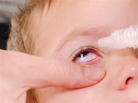 Childhood Glaucoma: Parents should watch out for these symptoms | The ...