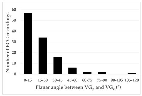 Intra-Individual Comparison of Sinus and Ectopic Beats Probing the ...