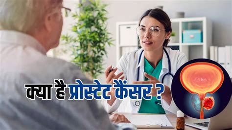 Prostate Cancer: पुरुषों को होने वाले इस रोग पर जरूर पूछे जाते हैं ये ...