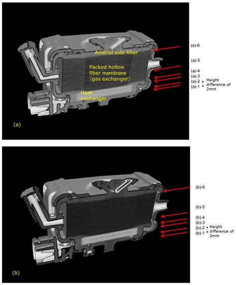 Newly Developed Pediatric Membrane Oxygenator that Suppresses Excessive ...