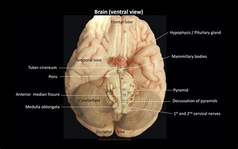 Ventral View Of Brain Diagram