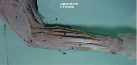 Image result for Extensor Digitorum Communis