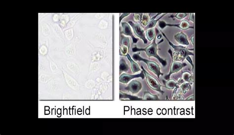 Dark field and Phase Contrast Microscope | PPTX