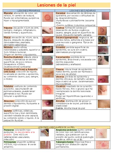 Lesiones DE LA PIEL - Lesiones de la piel LESIONES PRIMARIAS LESIONES SECUNDARIAS Macula: al ...