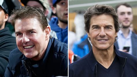 Tom Cruise Plastic Surgery Before And After Tom Cruise Accused Of