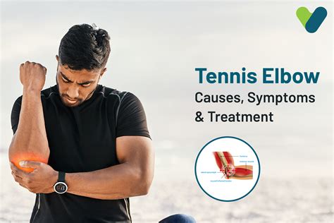 Tennis Elbow : Complete Guide to Causes, Symptoms & Treatment