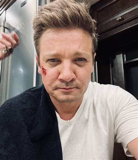 Jeremy Renner Aka Hawkeye Shares Bruised Pic After Accident 'I'm Too ...