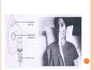 O2 Therapy Procedure 的图像结果