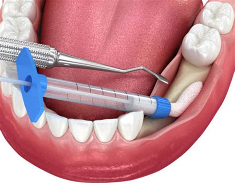 Dental Hospital in Vijayawada | Best Dental Clinic in Vijayawada ...