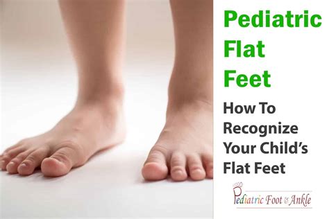 How to Recognize Flat Feet in Children - Pediatric Foot & Ankle