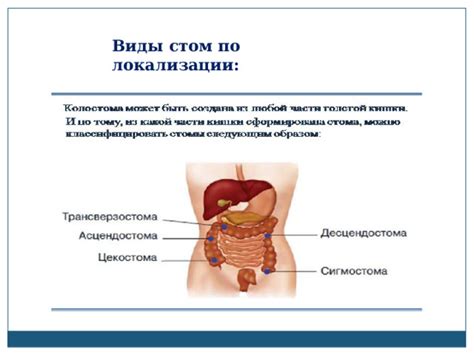Презентация "Стома. Уход за стомой."