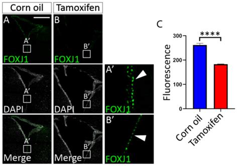 Hydrocephalus in Nfix−/− Mice Is Underpinned by Changes in Ependymal ...
