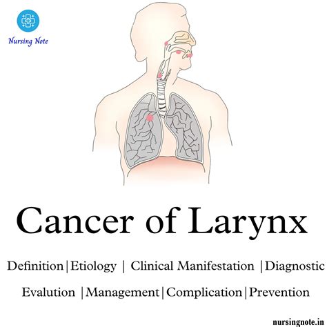 Cancer of Larynx or Laryngeal Cancer - 2nd Year GNM Medical Surgical ...